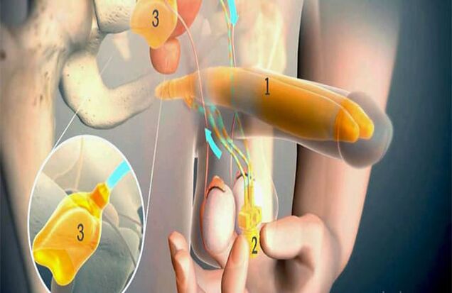Lipophilization surgery