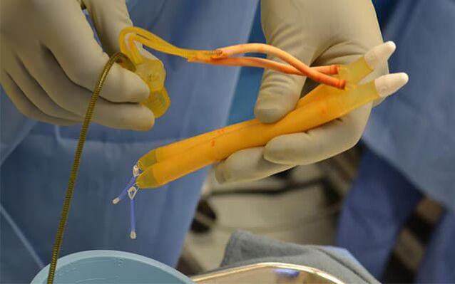 penis implants